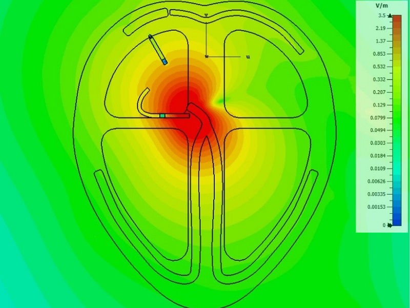 Herzrhythmus-Simulationsbild